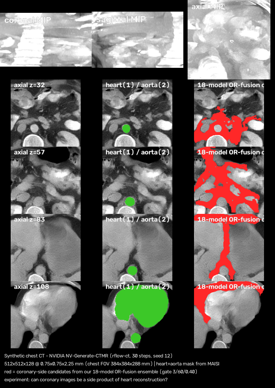 synthetic heart CT
