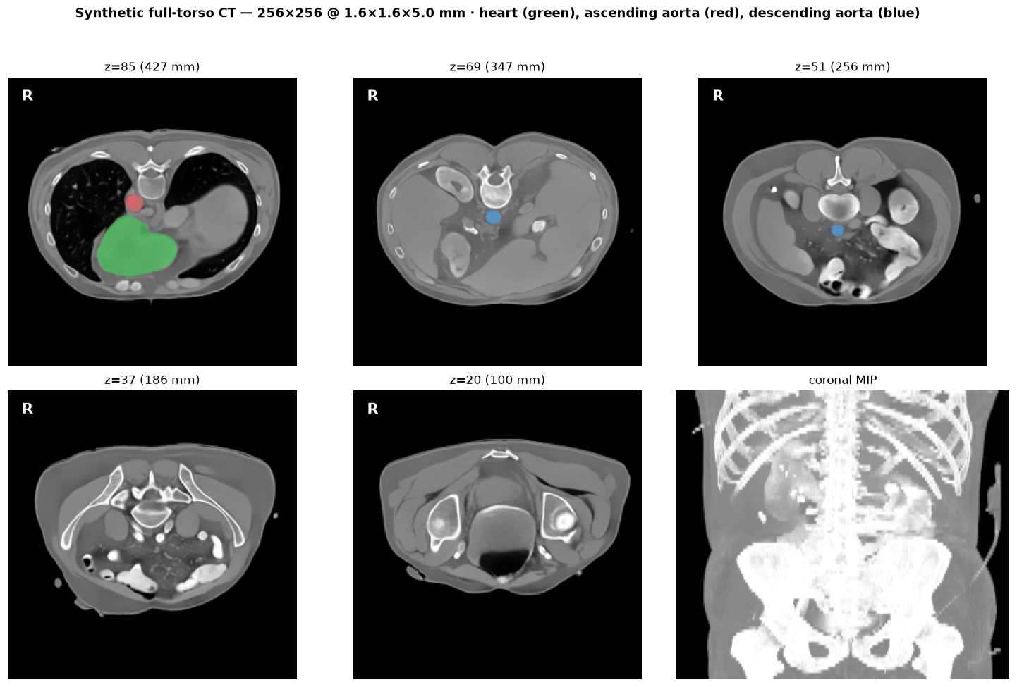 synthetic heart CT